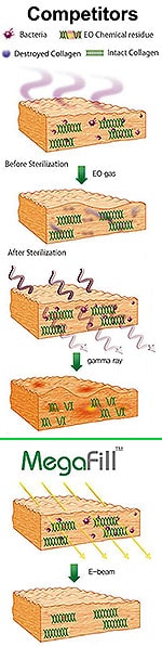 Sterilization of acellular dermal matrix allograft used for phalloplasty
