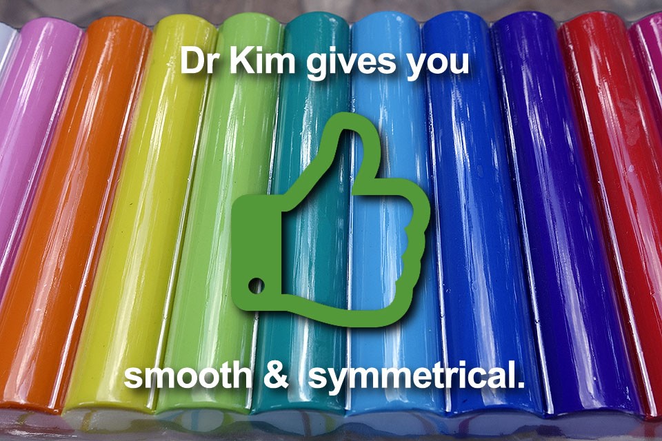 Six weeks of sculpting and adjustment massages keep phalloplasty result smooth and symmetrical