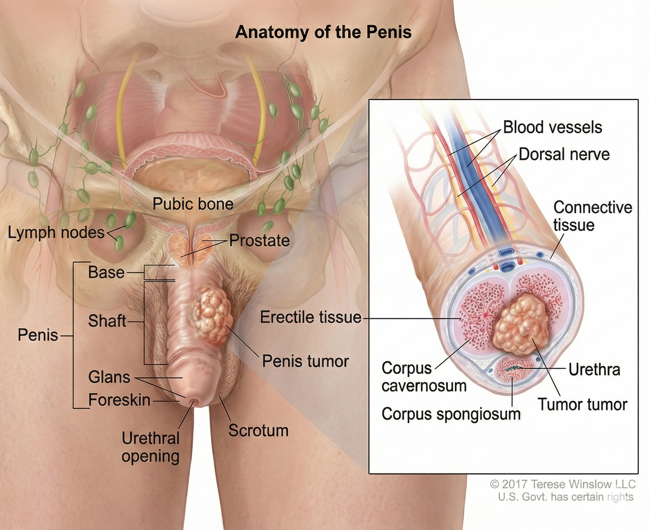 Never use petroleum derivative products for girth enhancement