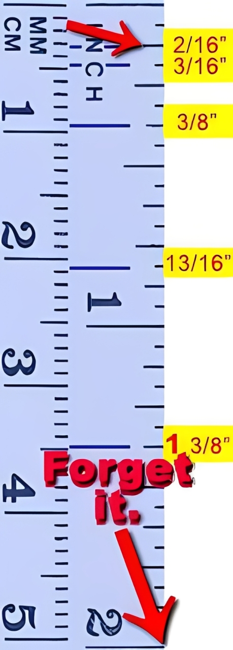 Penis lengthening by Dr Kim Jin Hong in his Seoul clinic